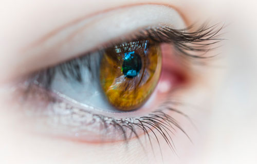 Find out more about glaucoma